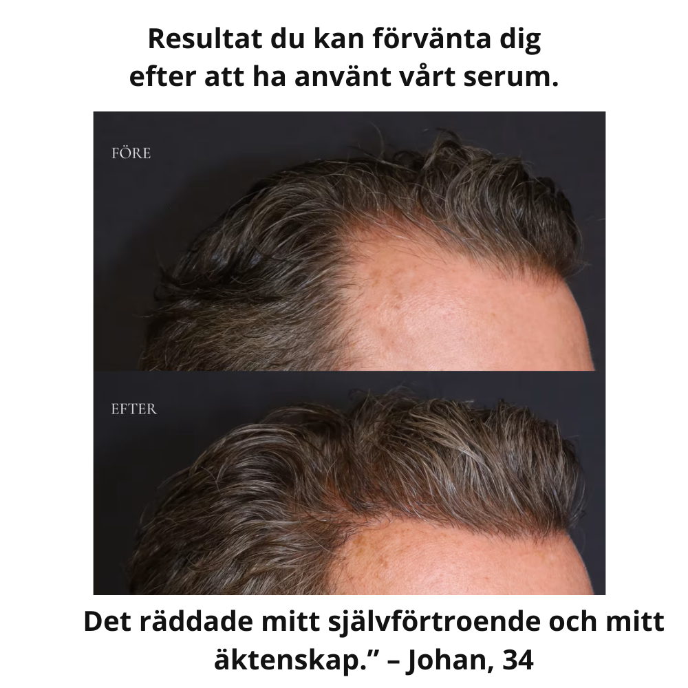 Hårväxtserum